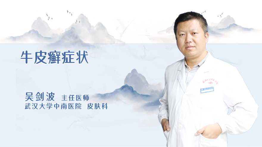 牛皮癣症状