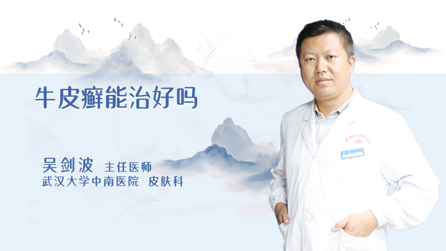 牛皮癣能治好吗