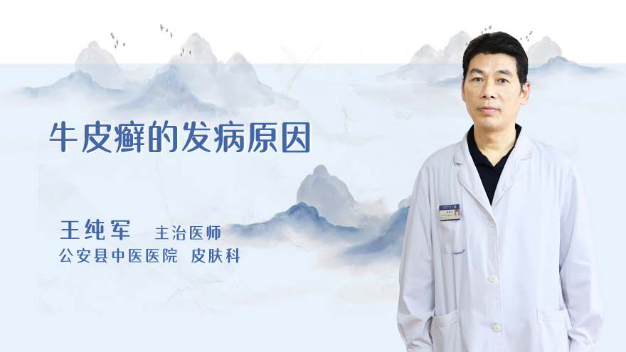 牛皮癣的发病原因