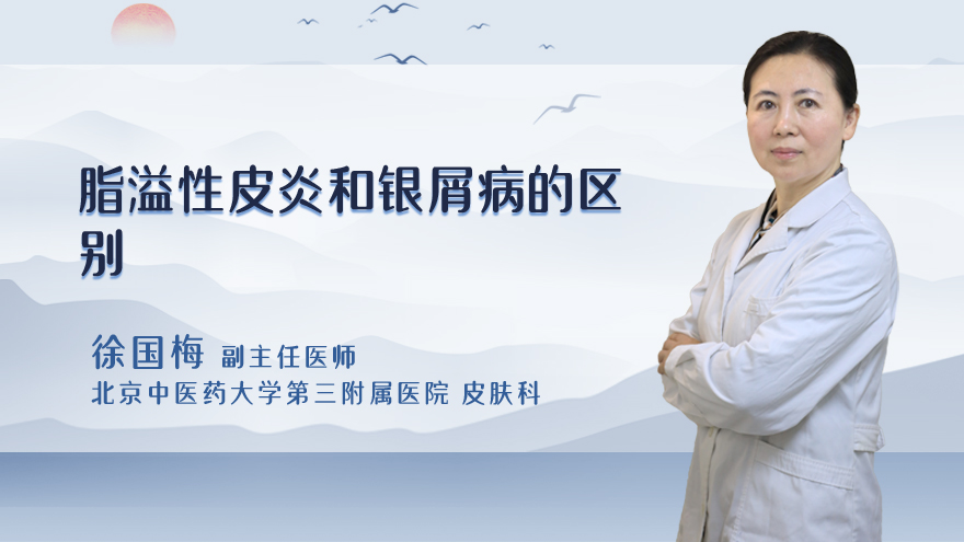 脂溢性皮炎和银屑病的区别