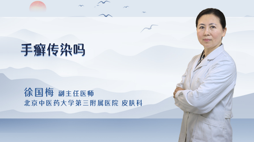 手癣传染吗