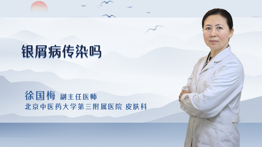 银屑病传染吗