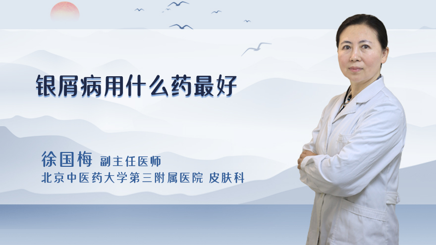 银屑病用什么药最好