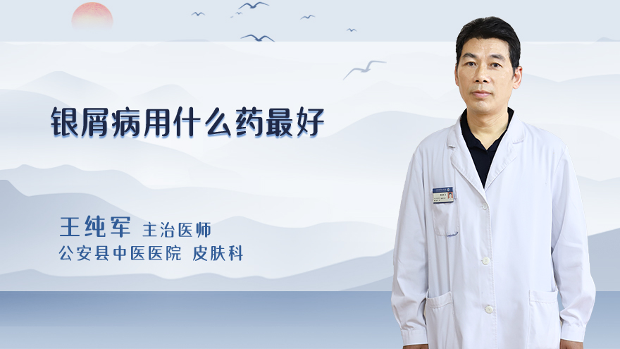 银屑病用什么药最好
