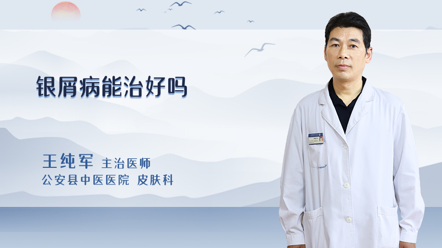 银屑病能治好吗