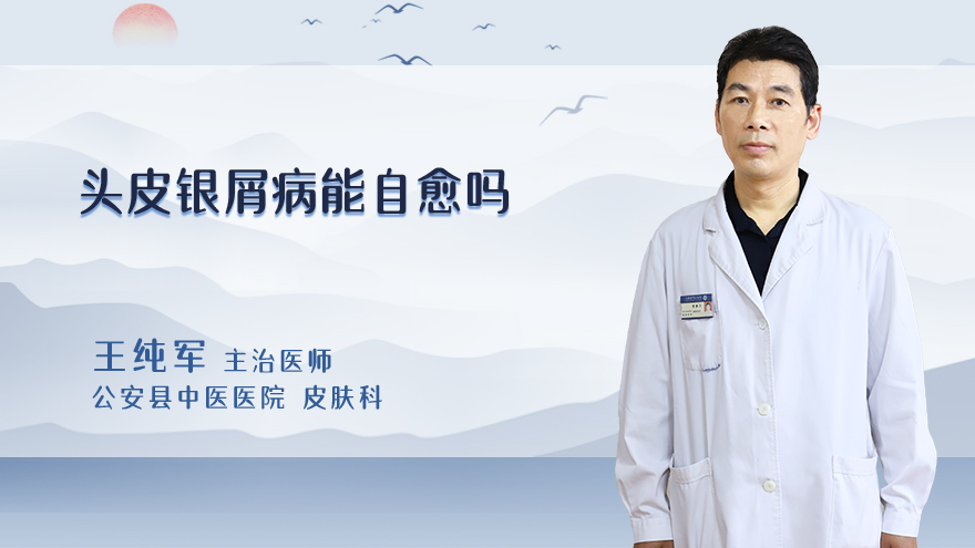 头皮银屑病能自愈吗