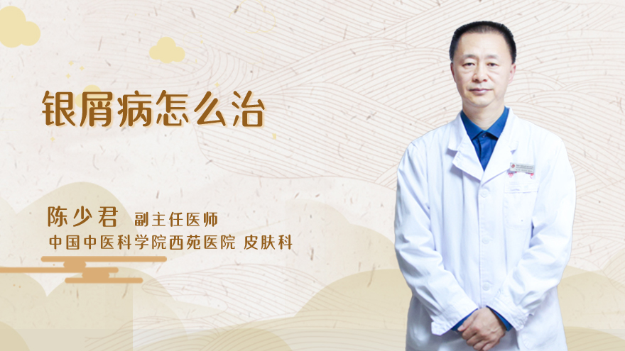 银屑病怎么治
