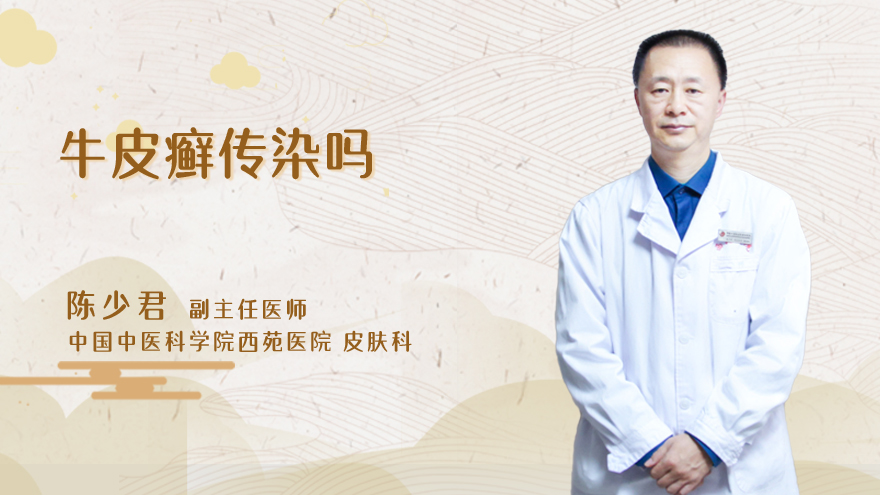 牛皮癣传染吗