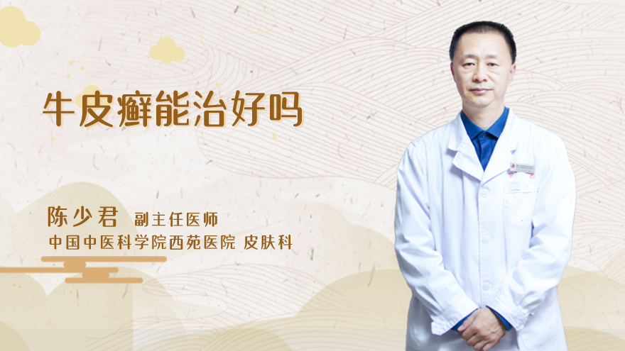 牛皮癣能治好吗