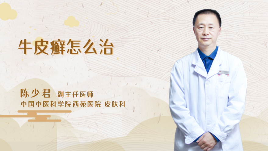 牛皮癣怎么治