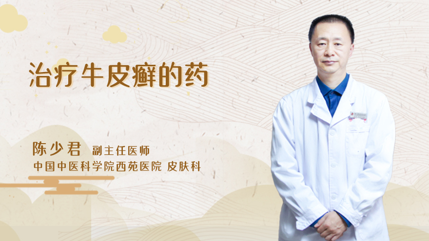 治疗牛皮癣的药