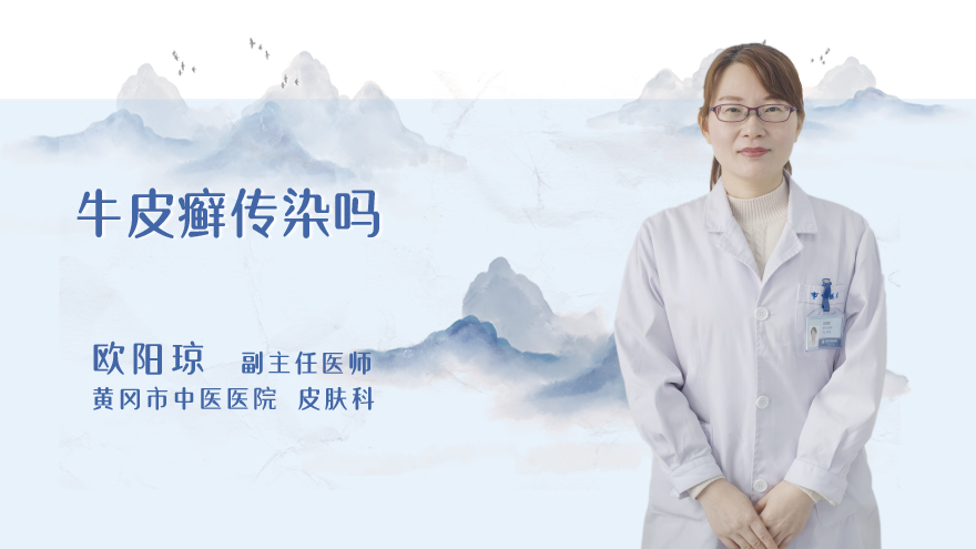 牛皮癣传染吗