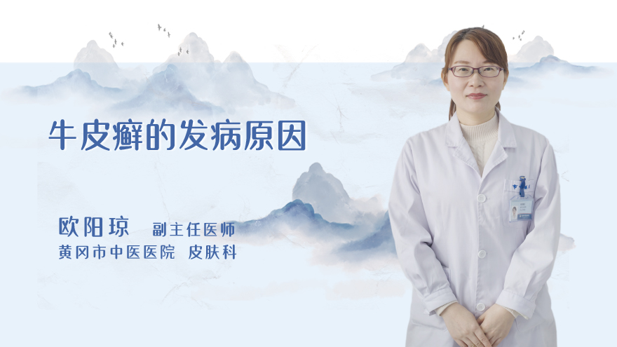 牛皮癣的发病原因
