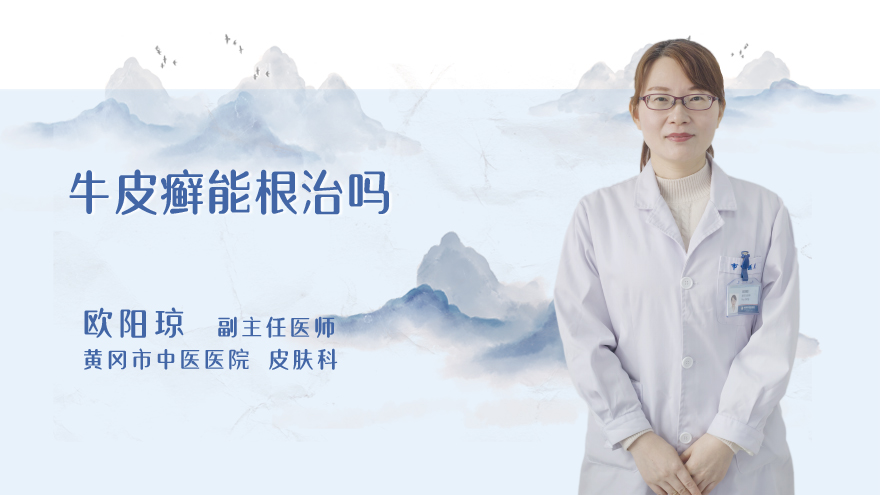 牛皮癣能根治吗