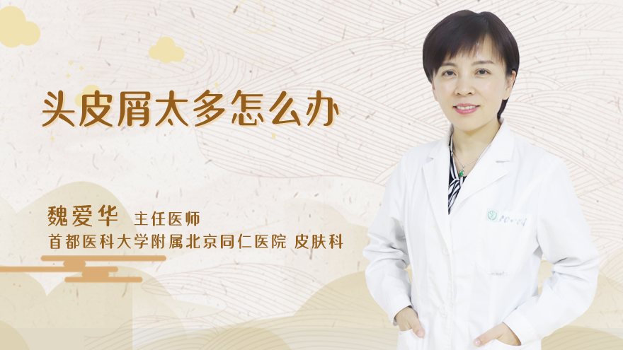 头皮屑太多怎么办