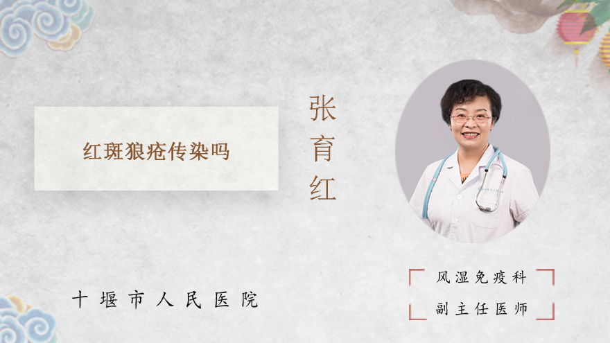红斑狼疮传染吗