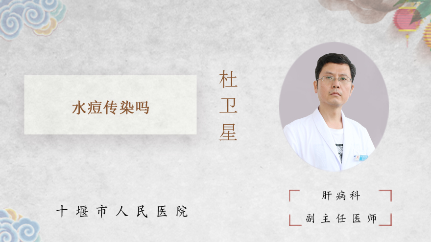 水痘传染吗