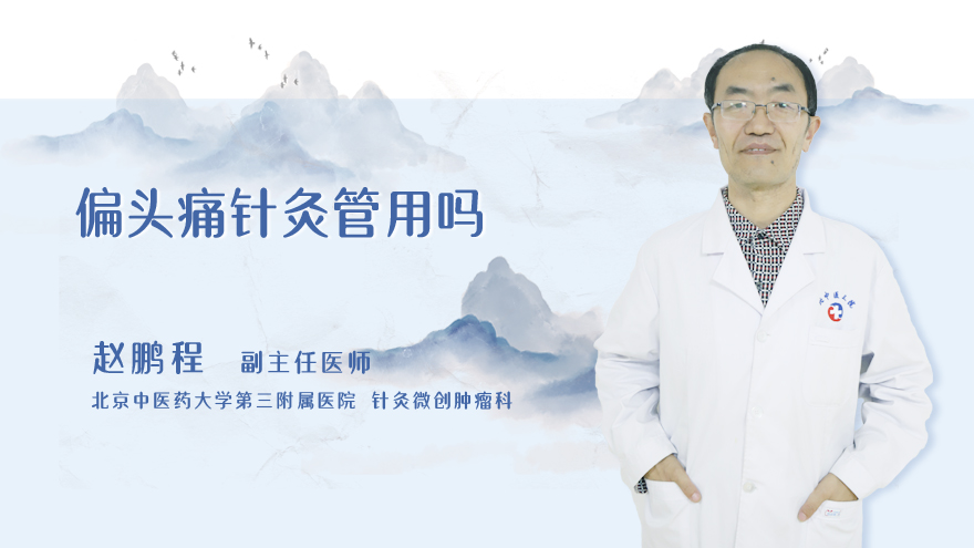 偏头痛针灸管用吗